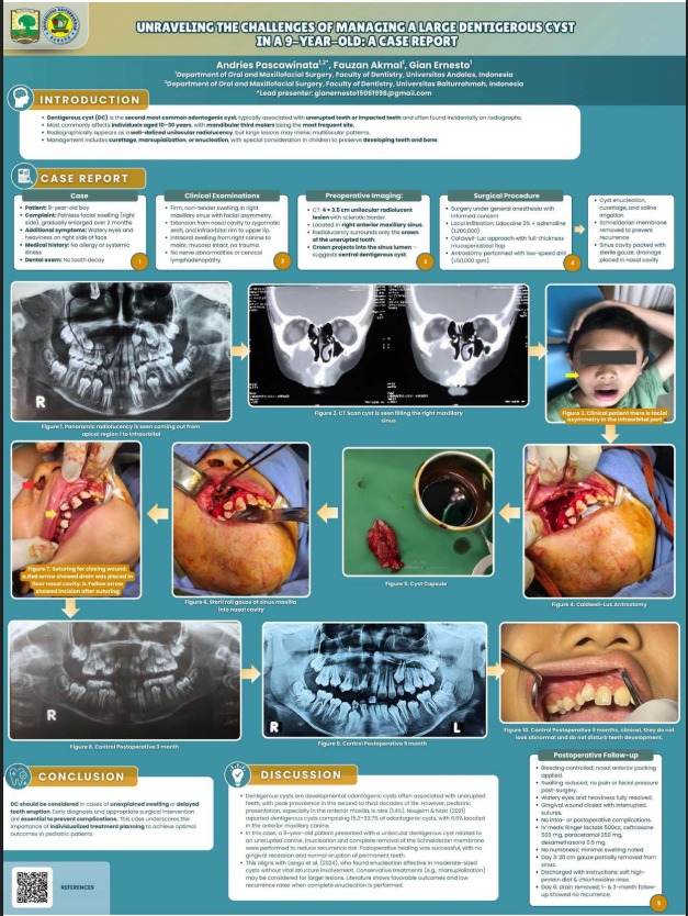 Unraveling the chalenges of managing a large dentigerous cyst in a 9 years old: a case report
